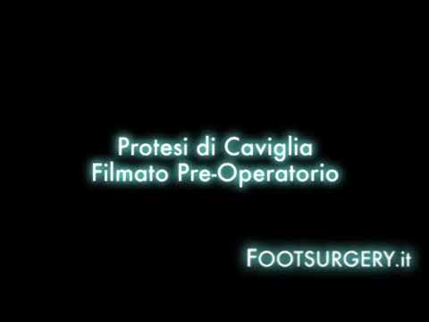 Rigidità mattutina delle articolazioni si osserva in prova Nevrosi provoca il mal di schiena