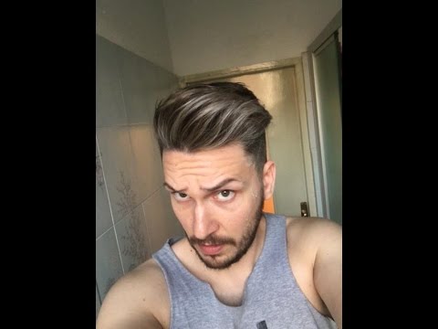 La ragione di apparizione di pigmentary nota su una faccia a donne Come si libererà da consigli di lentiggini