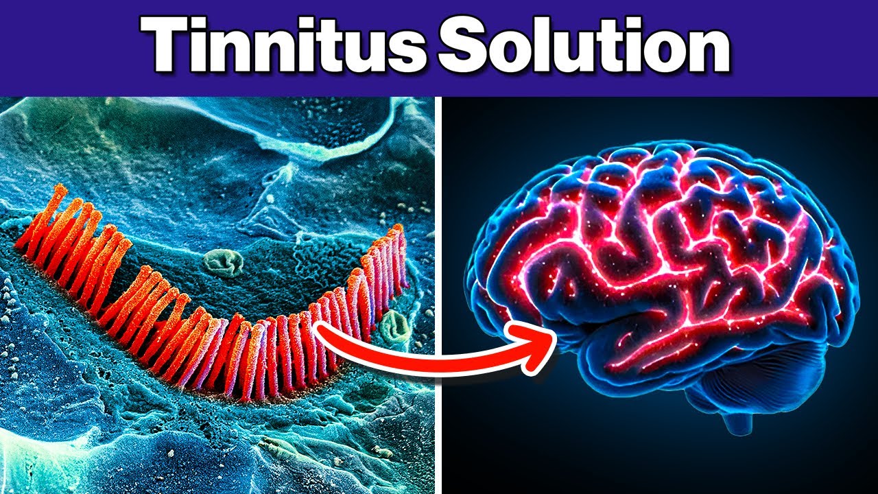 The SHOCKING Truth About Tinnitus And Your Brain