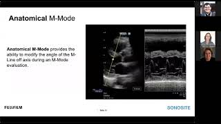 Sonosite LX: A Step Forward in Caring for Your Critically Ill Patients