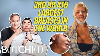 Droopy Diva Lacey: 3rd BIGGEST Breasts in the World & Wants MORE Surgery  (RESULTS) | Botched | E!