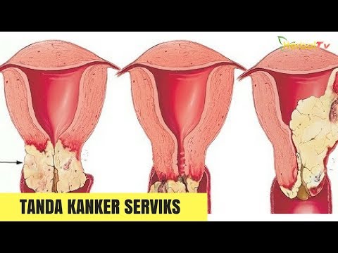Jahe impotensi Perhatikan bagaimana untuk menggairahkan wanita