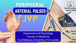Peripheral Arterial Pulses and JVP