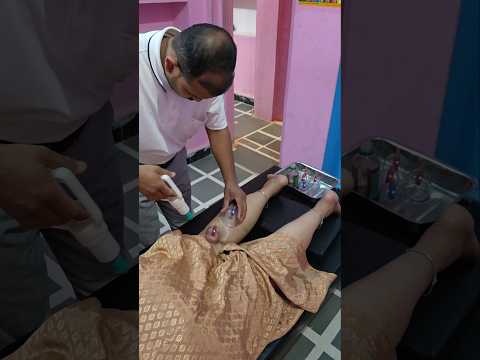Calf muscle pain treatment for cupping therapy and | wet loss treatment