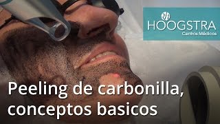 Cómo se realiza un peeling de carbonilla - Conceptos básicos (16029)