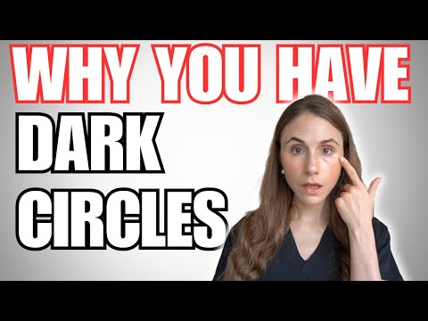 8 Reasons Why You Have Dark Circles