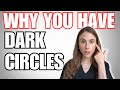 8 Reasons Why You Have Dark Circles
