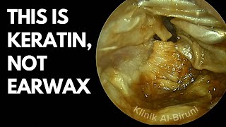 Download lagu This is Keratin, Not Earwax mp3 Download lagu This is Keratin, Not Earwax mp3