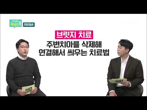2021/12/17 TV닥터처방전 – 치아결손