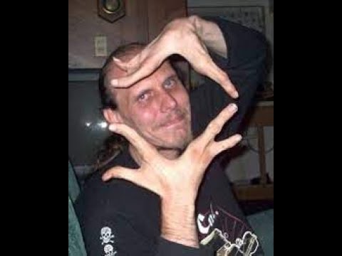 The Tragic Fate of Lobster Boy’s Son 😢 | The Forgotten Stiles Story