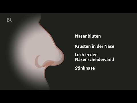 Wie ist es, süchtig nach Nasenspray zu sein?