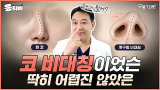 [무.물] 코 비대칭, 원인부터 해결까지 한 번에!｜1%성형외과  #김종구 #코수술 #코재수술