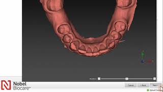 2  How to Import STL files and create virtual teeth recover