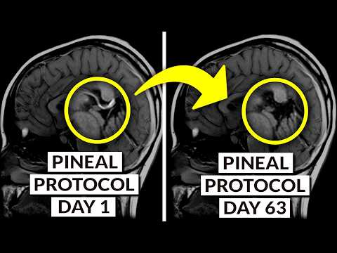 We Finally Know How To DECALCIFY The Pineal Gland