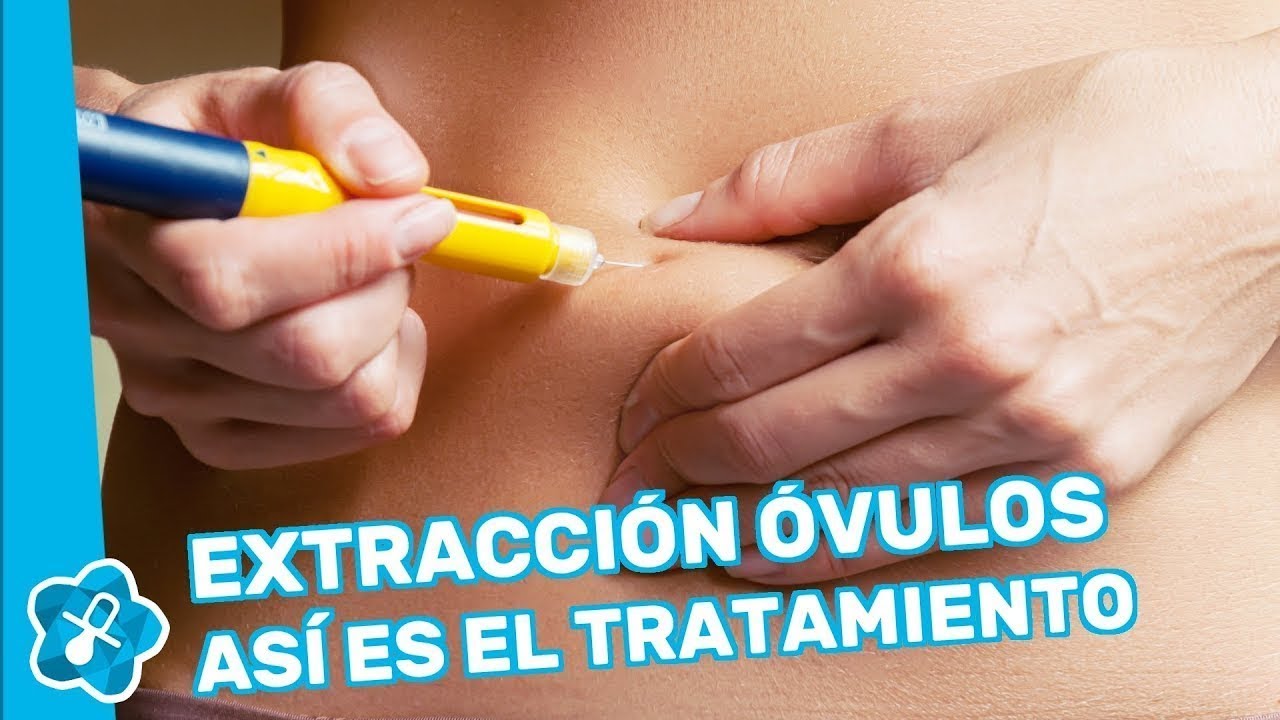 Watch Extracción de óvulos para congelarlos, paso a paso Now Extracción de óvulos para congelarlos, paso a paso