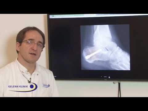 Vorrichtung Massage mit zervikaler Osteochondrose Verrenkungen von Gelenken Phalanx