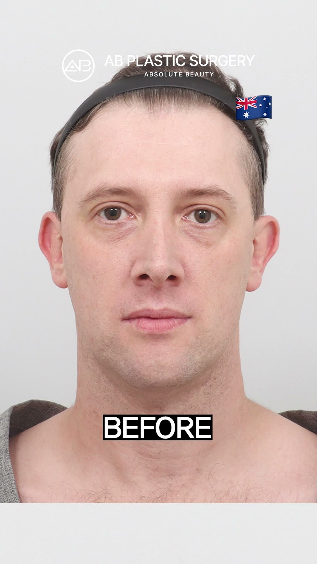 This Is What a Full Face Refresh Looks Like
