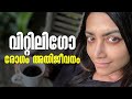 ചർമ്മത്തിലുണ്ടാകുന്ന വിറ്റിലി​ഗോ ര�