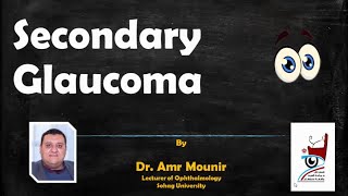 Secondary Glaucoma
