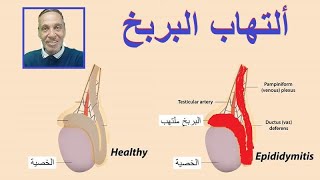 ألتهابات البربخ أعراض ألتهاب البربخ وعلاجه