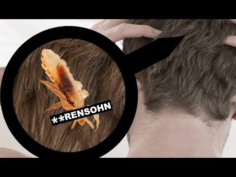 Läuse die **rensöhne