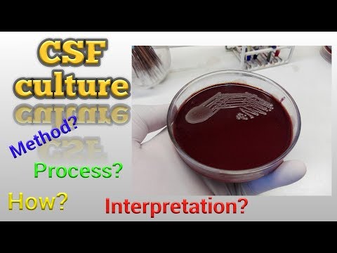 CSF Culture test procedure Microbiology