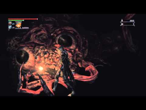 Bloodborne: WTF is that!?! [PS4]