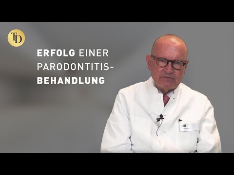 Wie sind die Erfolgschancen einer Parodontitis-Behandlung?