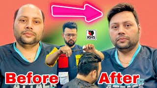 Hair Patch For Men | Hair Transformation | Natural Hairline Hair Patch | 9599858612 |