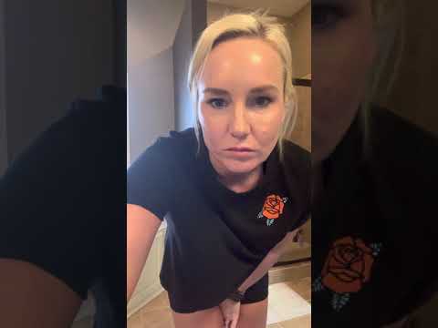 5 month post op tummy tuck/ preop flankplasty aka buttock or posterior lift- NOT brazilian