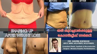 Shaping up after weight loss - തടി കുറച്ചവർക്കുള്ള കോസ്മെറ്റിക് സർജറി - Dr. Harin Asokan