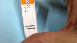 etg test