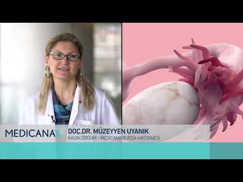 Erkek İnfertilitesi (Kısırlık) Testi | Op. Dr. Tansel Kaplancan