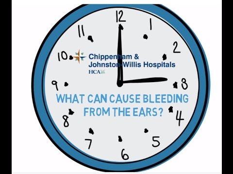 CJW Doc Minute: What can cause bleeding from the ears?