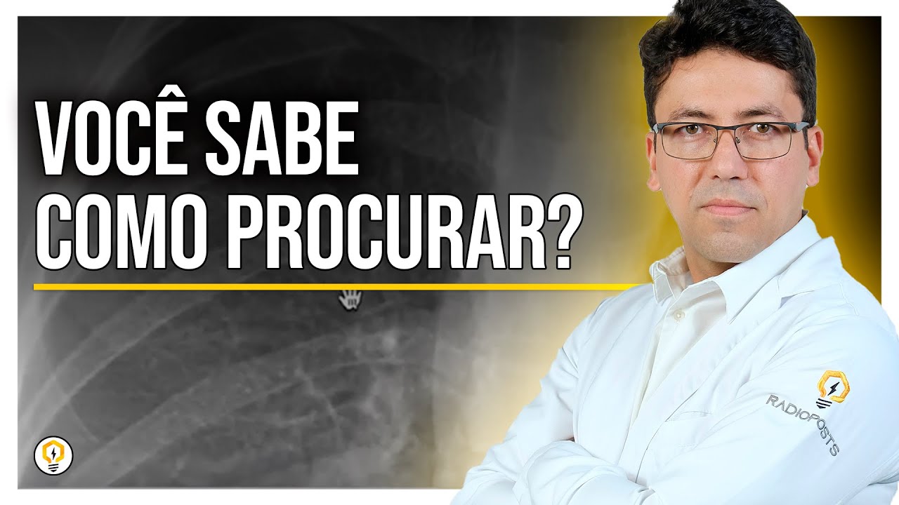 Como Identificar PNEUMOTÓRAX na Radiografia