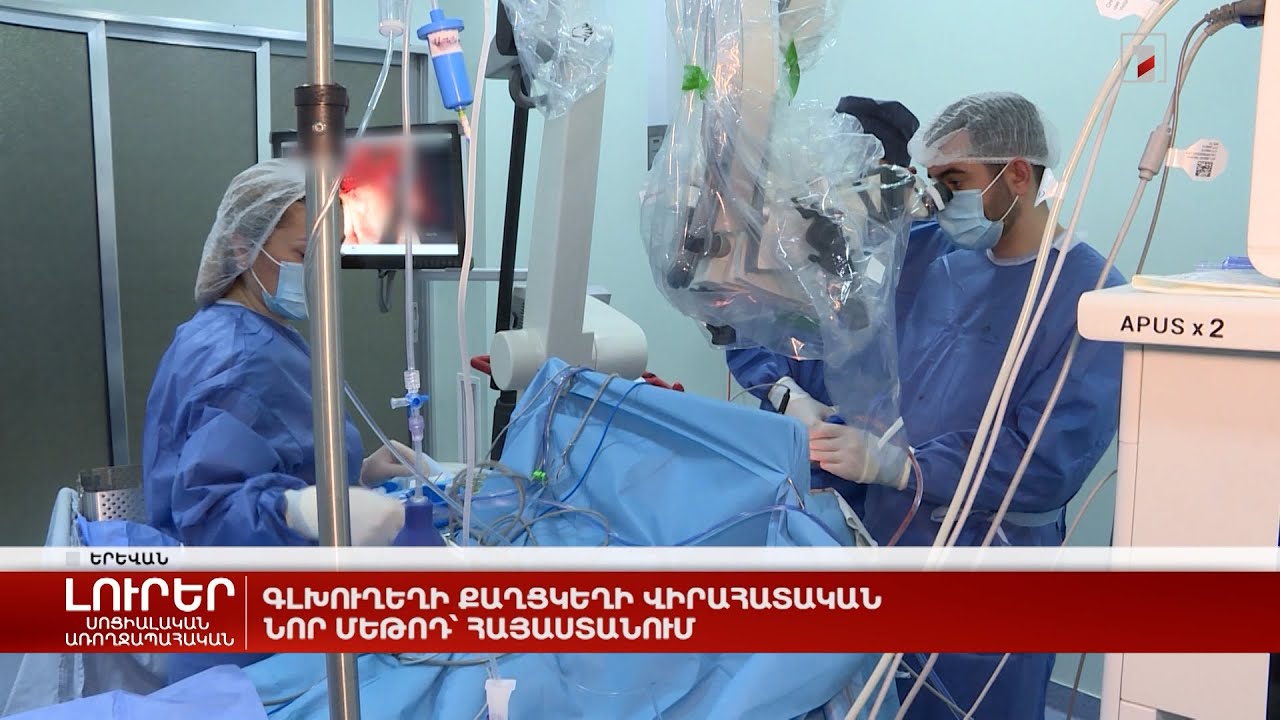Գլխուղեղի քաղցկեղի վիրահատական նոր մեթոդ՝ Հայաստանում
