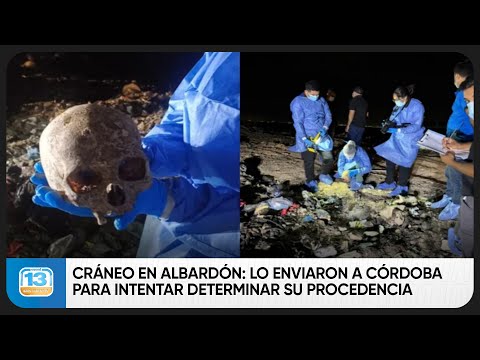 Cráneo en Albardón: lo enviaron a Córdoba para intentar determinar su procedencia antropológica