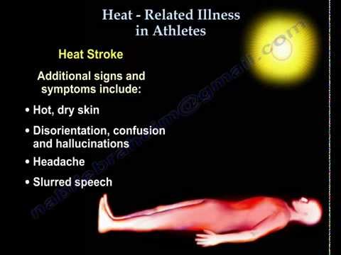 Heat illness in athletes - Everything You Need To Know - Dr. Nabil Ebraheim
