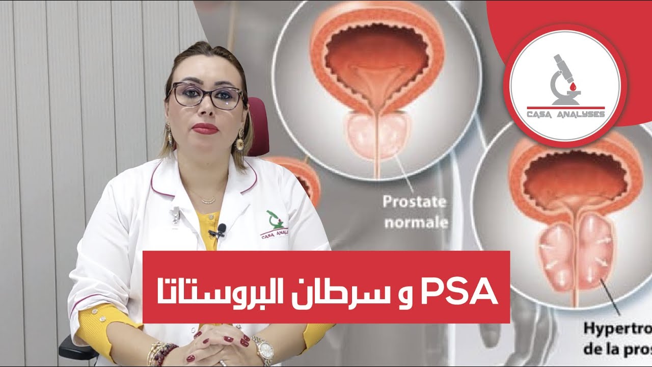 تحليلة PSA و سرطان البروستاتا