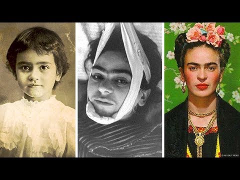 La Tragique Histoire de Frida Kahlo
