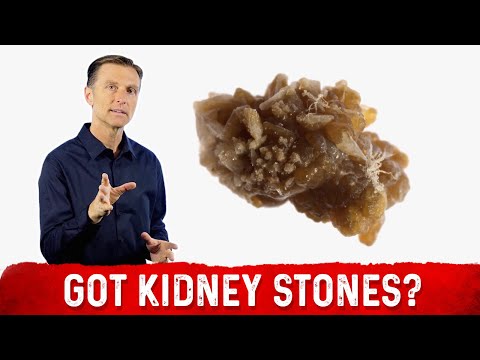 The Top SUPERFOODS for the Kidneys—Explained by Dr Berg