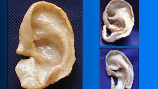 Teórico Oído (Parte 1)