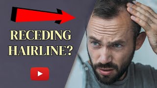 How To Stop Your Receding Hairline? [EXPERT ADVICE]