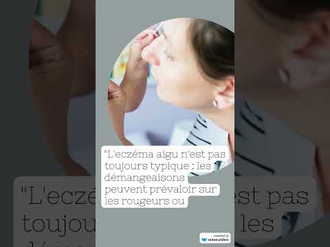 Vidéo : l'eczéma expliqué par le dermatologue