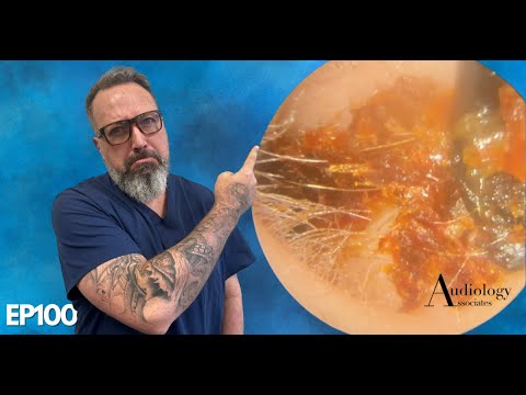 CHILDS EAR WAX REMOVAL MADE ME ANGRY! - EP1008