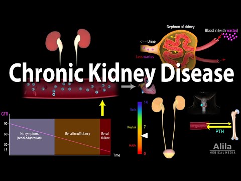 Chronic Kidney Disease, Animation