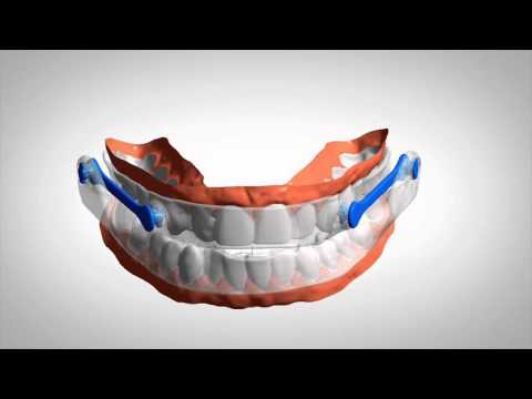 Hur tillverkas Narval CC?