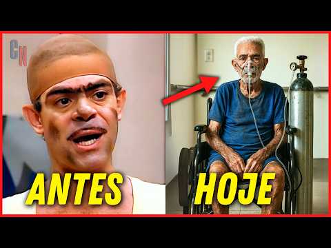 O TRISTE FIM DE 10 ATORES ESQUECIDOS DA ESCOLINHA DO PROF. RAIMUNDO! ?