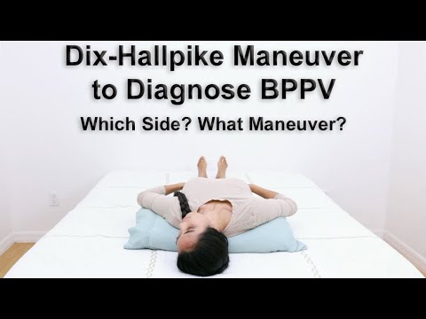 Dix Hallpike Maneuver to Diagnose BPPV - What Side and What Type for Proper Treatment