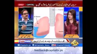 Dr Mohsin Hasan on Viral Infections 